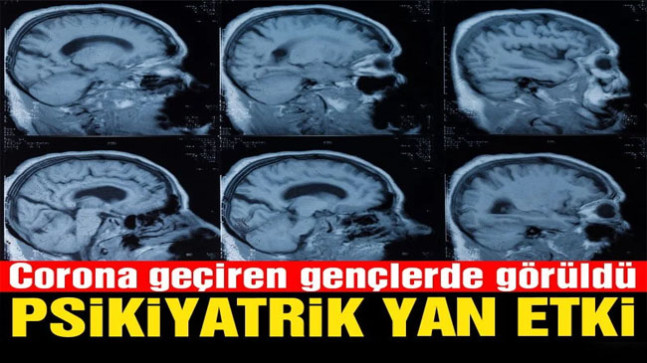 ABD’li uzmanlardan dikkat çeken çalışma