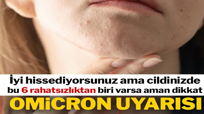 Uzmanlar uyardı: İyi hissediyorsanız ama  bu belirtiler varsa Omicron olabilir