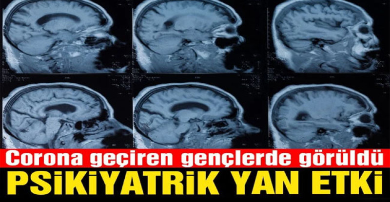 ABD’li uzmanlardan dikkat çeken çalışma